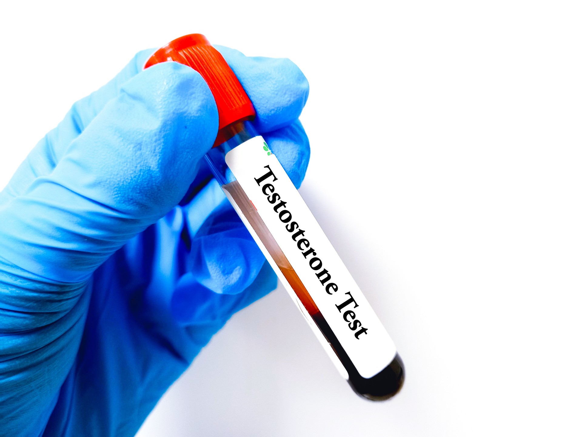 A doctor is holding a test blood sample tube with a Testosterone test. A blood sample for Testosterone test.